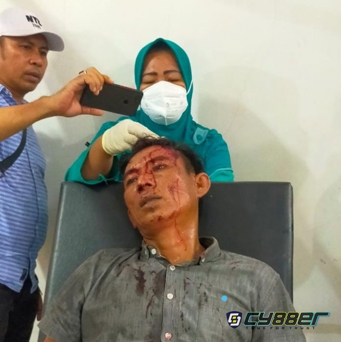 Bentrok di Gerbang PT.HIM Milik Abu Rizal Bakri Akibatkan Salah Satu Warga Alami Pecah Kepala.