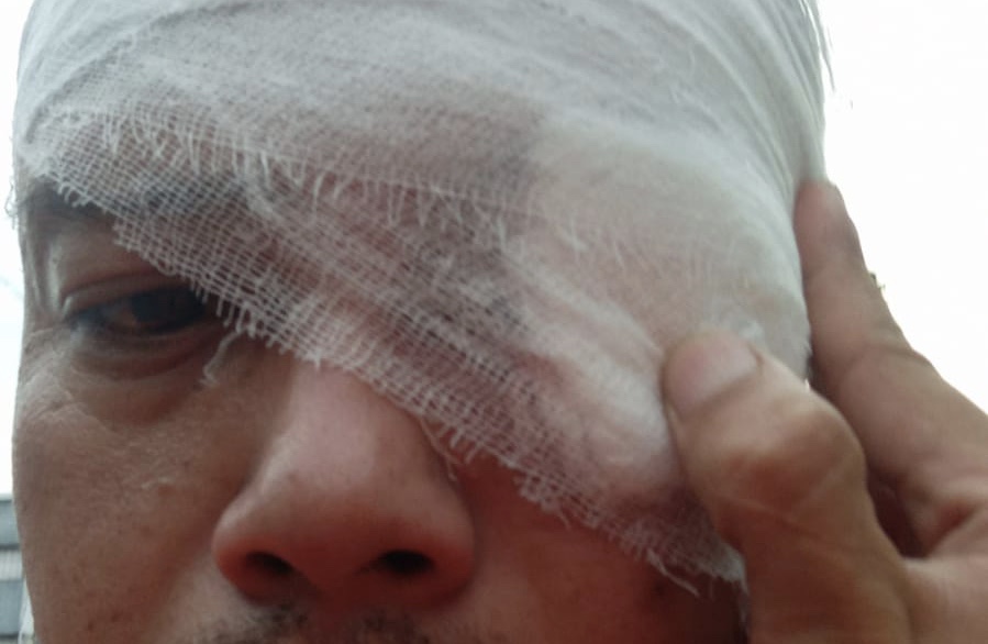 Oknum Polisi Aniaya Wartawan di Sumedang