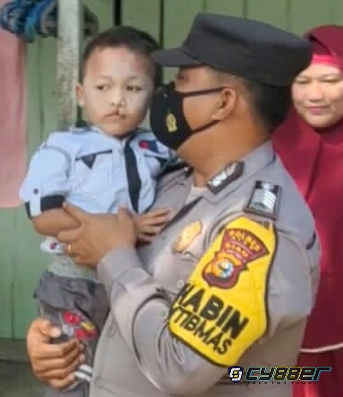 Operasi Bibir Sumbing, Warga Kandis Ucapkan Terima Kasih Kepada Pori