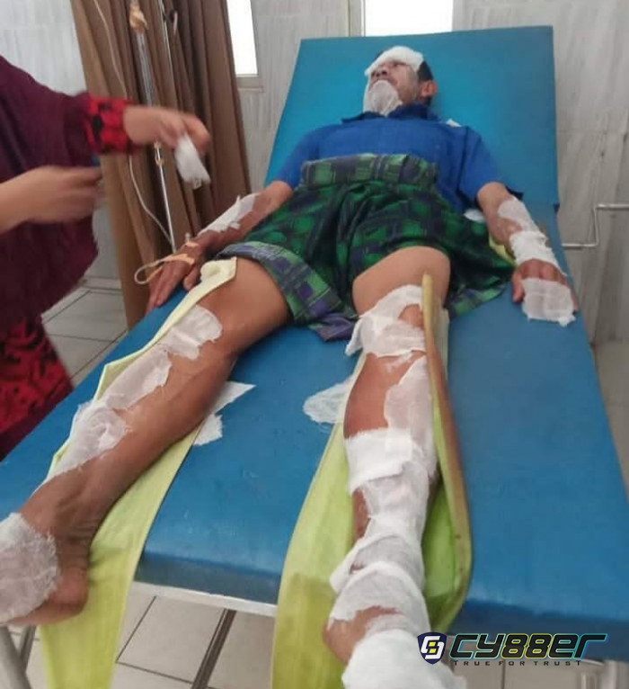 Warga Pekon Sinar Betung Nyaris Di Lalap Api Akibat Selang Gas Bocor