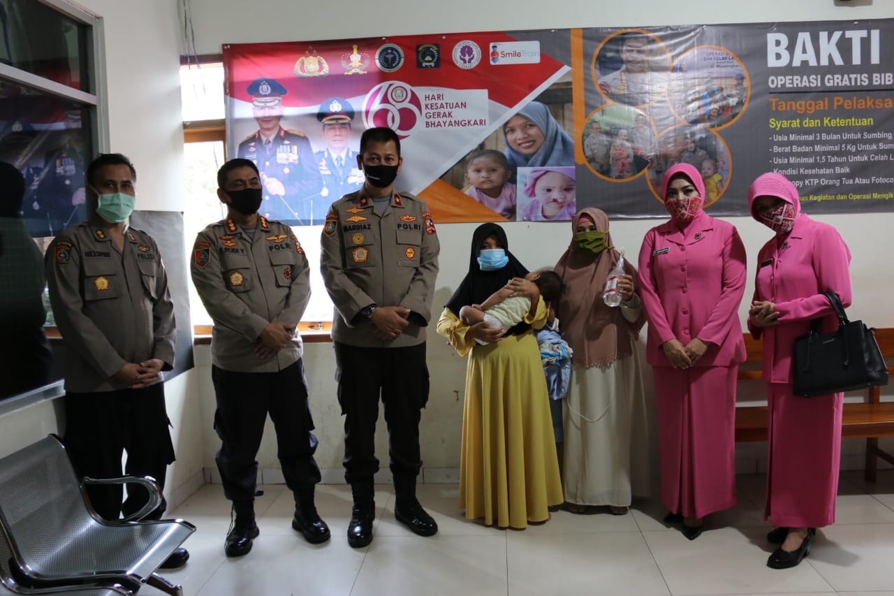 Setukpa Lemdiklat Polri Menyelenggarakan Baksos Operasi Bibir Sumbing 