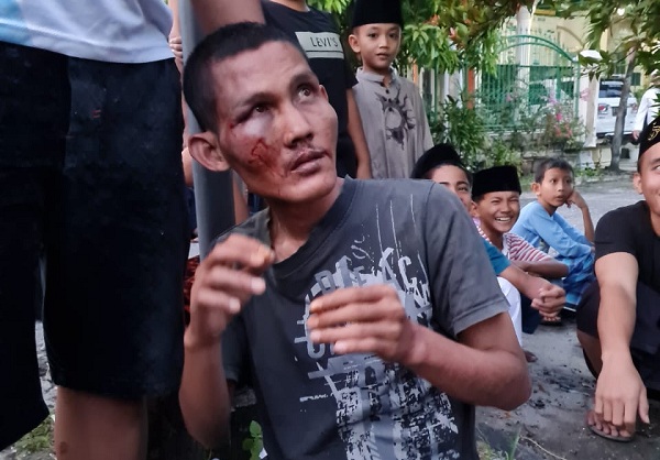 Saat Pimpin Shalat Berjamaah, Seorang Imam Masjid Dipukul Orang Tak Dikenal