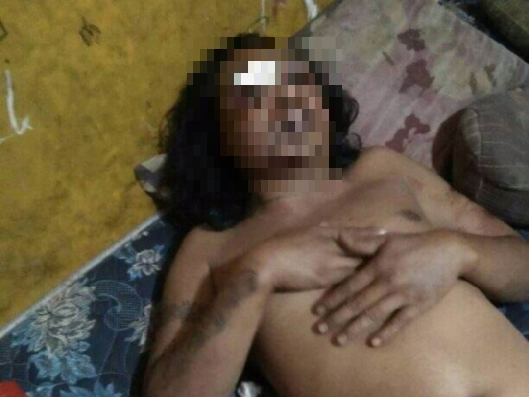 Salah Sasaran, Kirno Dikeroyok Warga Sampai Luka Parah