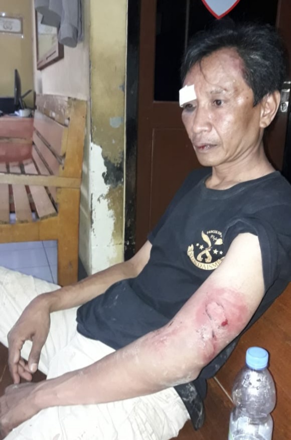 Bos Tambang Ilegal Aniaya Wartawan Hingga Babak Belur