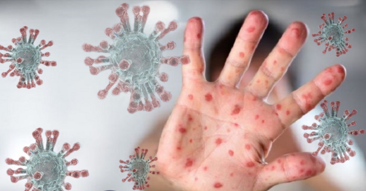 Ratusan Tamu Asal Inggris Dikarantina Karena Varian Baru Virus Corona