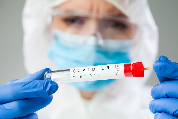 Hasil Rapid Test Antigen, Tak Ada Warga Positif Covid dalam Kerumunan Jokowi di NTT