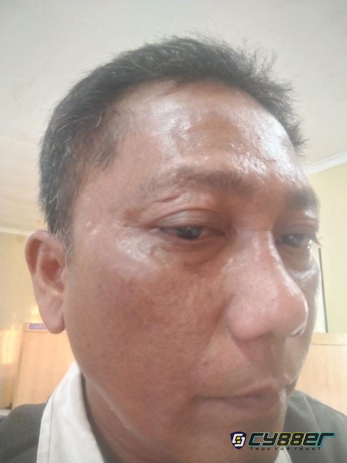 DPD PJS Sumut Desak Penangkapan Pelaku Penganiayaan Wartawan di Toba