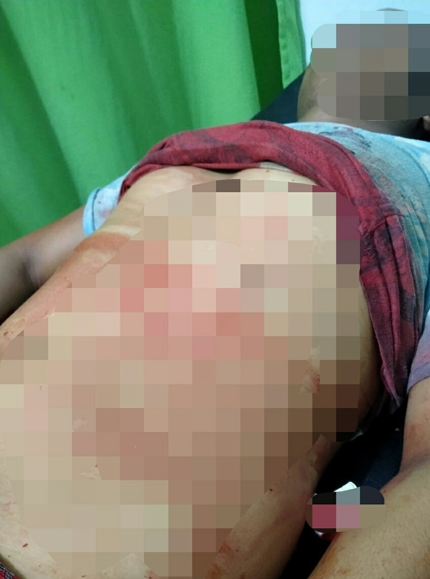 Ditikam di Jantung, J.Panjaitan Tewas di Tangan ED