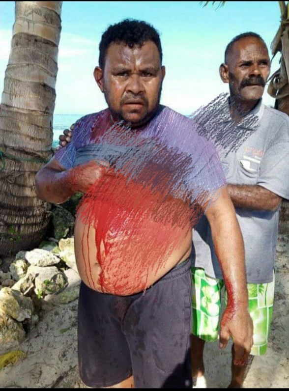Insiden Berdarah di Kampung Boni Belum Juga Ditangani, Kuasa Hukum Korban Desak Penyidik
