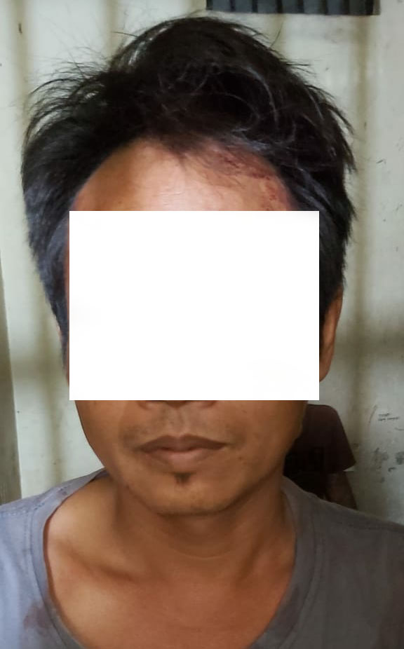 Aniaya Tetangga Sampai Luka KA masuk Bui,Terungkap Karna Dendam