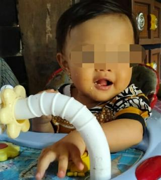 Bayi Tanpa Anus di Desa Sialang Dua Dahan Kecamatan Rengat Barat Uluran Tangan