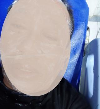 Tega!!! Seorang Guru di Karawang Disiram Rekan Bisnisnya dengan Cairan Diduga Kimia