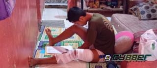 Miris !  Anak Alami Luka Bakar 30 Persen, Keluarga Soroti Minimnya Respons Pemerintah Kota Cilegon