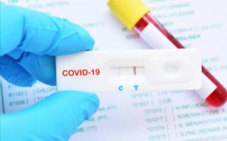 Warga Keluar Masuk Kabupaten Banyumas Wajib Tes Antigen