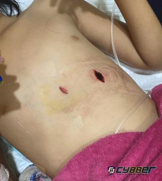 Ayah di Tulang Bawang Barat Tega Tikam Anak Kandung, Diduga Dipengaruhi Sabu