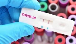 Dari 77.671 Orang Jalani Rapid Test di Jakarta, 3,8 Persen Lebih Terindikasi Positif Covid-19