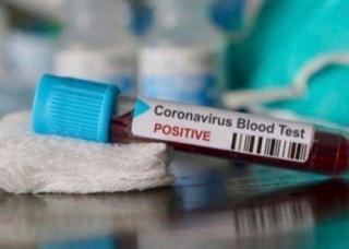 Managemen PT. CPI Akui Salah Satu Karyawannya Positif Covid-19