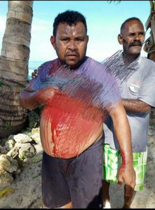 Insiden Berdarah di Kampung Boni Belum Juga Ditangani, Kuasa Hukum Korban Desak Penyidik